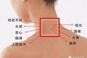 面部为什么过敏(面部为什么过敏起皮)