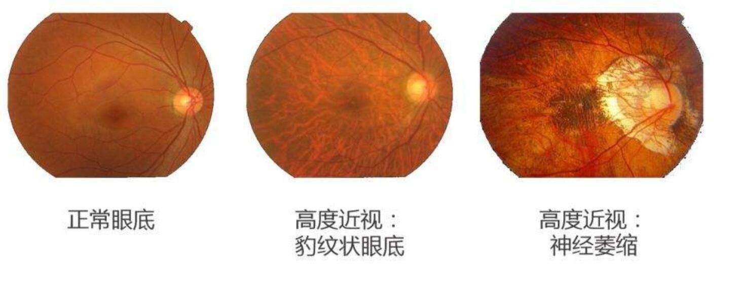 营销近视症(什么观念会导致营销近视症)