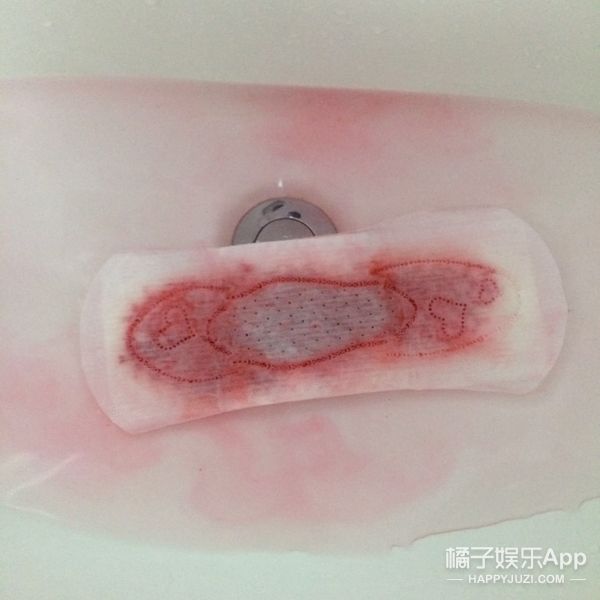 姨妈血发白(姨妈血泛白是怎么了)