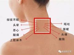 面部为什么过敏(面部为什么过敏起皮)